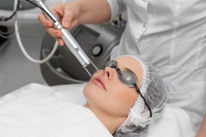 skin laser treatments sydney